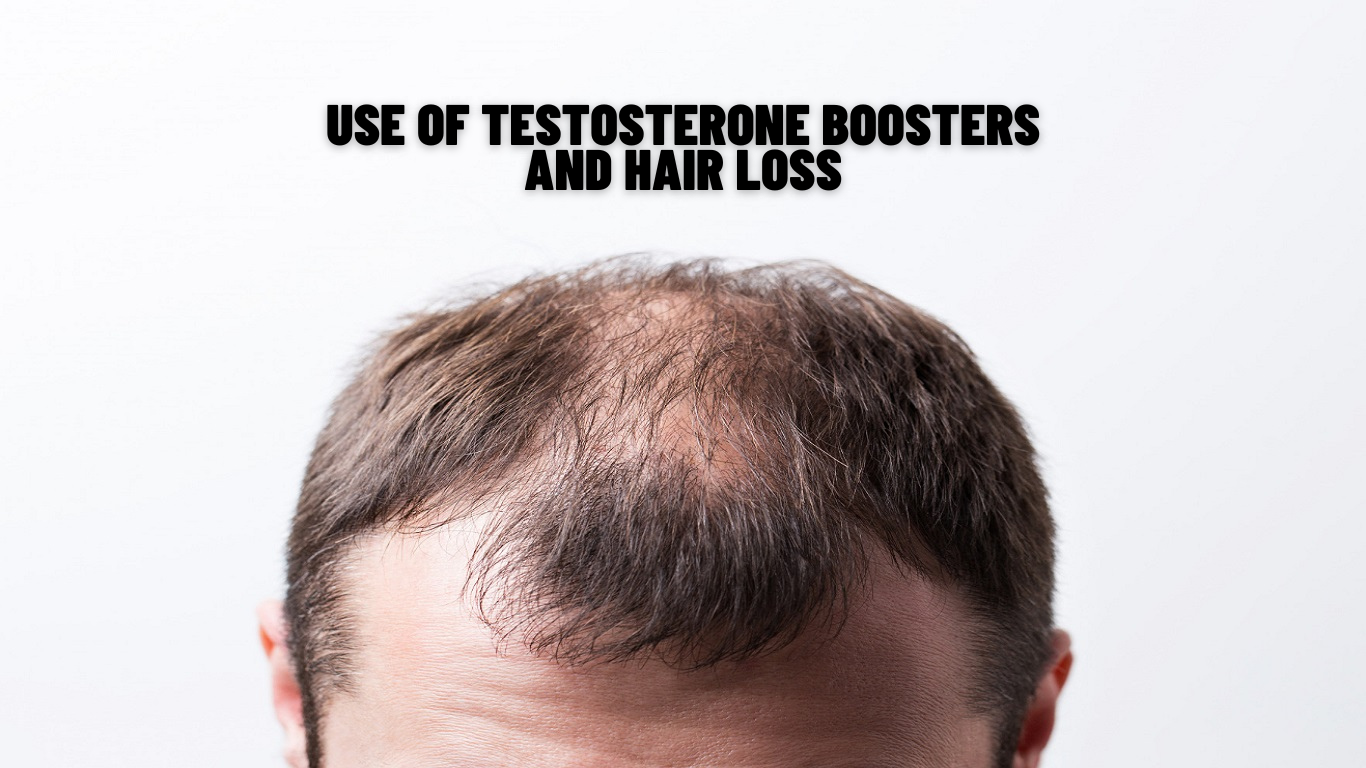 Use Of Testosterone Boosters And Hair Loss